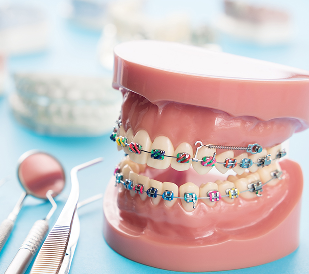 4 Popular Orthodontist Treatments - Henry Orthodontics Pinehurst, North  Carolina